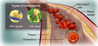 Click image to enlarge Cholesterol in the blood stream