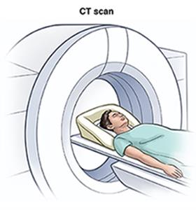 Person lying on table, entering donut-shaped machine for CT scan.