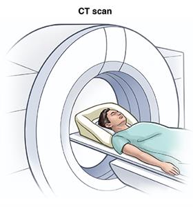 Patient lying on table going through donut-shaped scanner for CT scan.